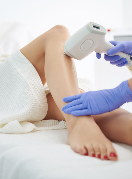 Depilazione laser