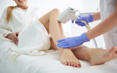 Depilazione laser